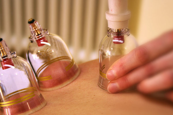 photo-cupping